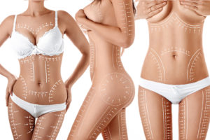 Moeller-Medical-liposuction-blog-2-banner-1600x1067px